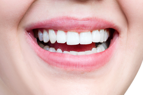Close up of dental patient's Smile Design treatment including composite bonding